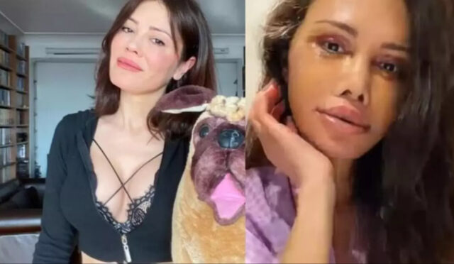 Didem Ceran Yüz Nakli Sonrası Yorum Yağmuruna Tutuldu